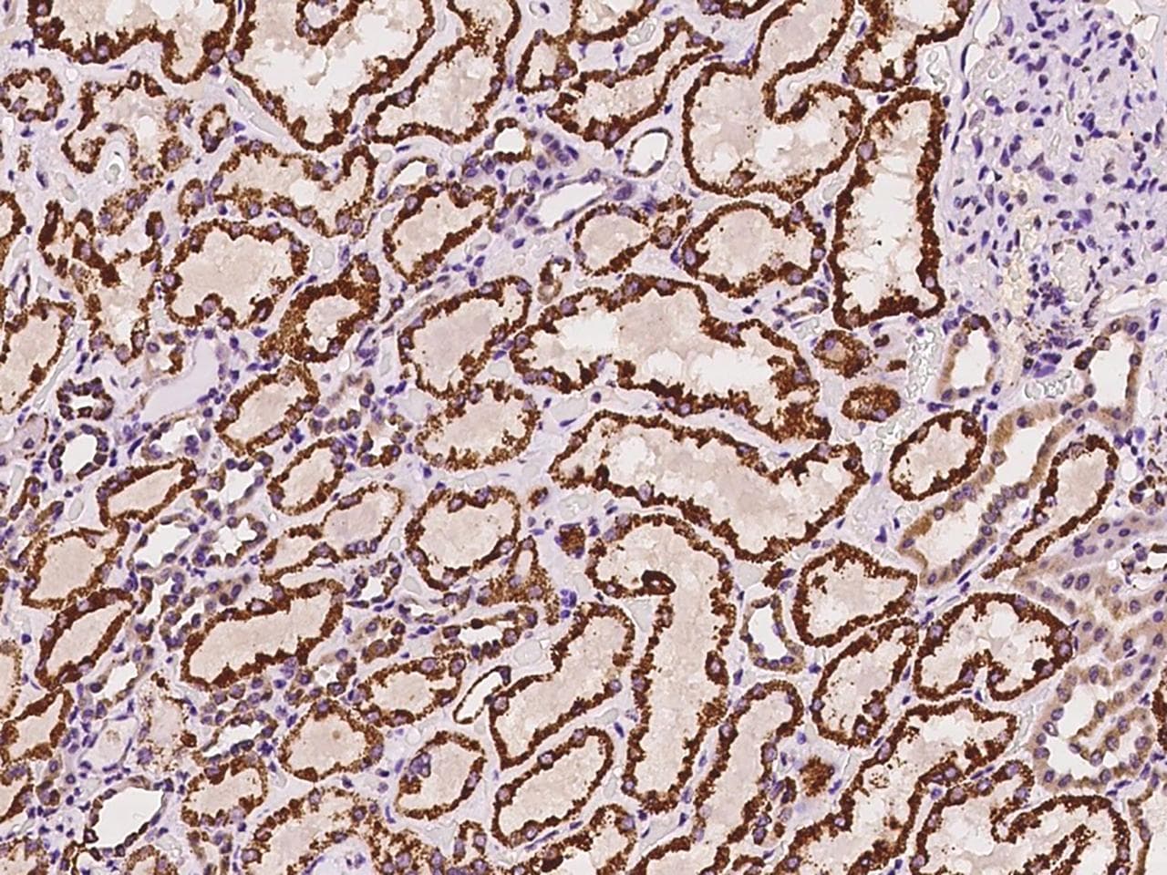 P5CDH / ALDH4A1 Antibody