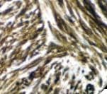 ANO1 / DOG1 / TMEM16A Antibody (clone RBT-DOG1, Ready-to-Use)