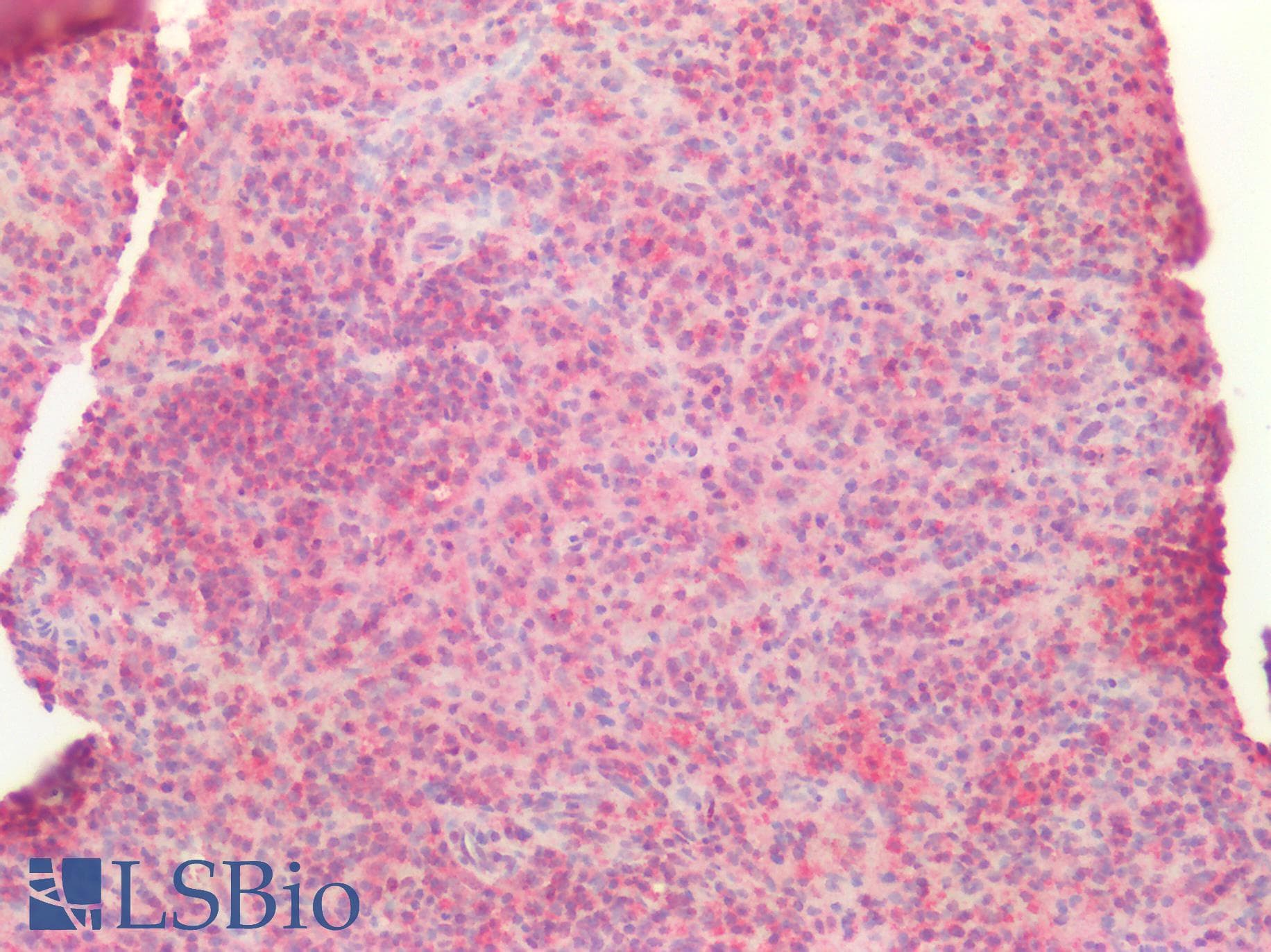 PathPlus™ CASP10 / Caspase 10 Antibody
