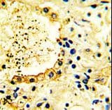TNK2 / ACK1 Antibody (aa10-39)