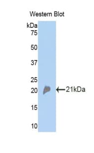 Properdin / CFP Antibody (aa310-459)