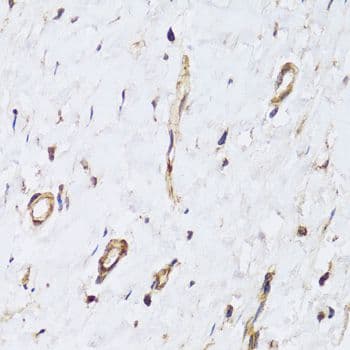 PECAM-1 / CD31 Antibody