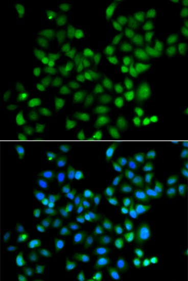ZNF187 Antibody