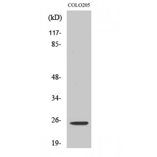 Polyclonal Rabbit anti-Human HOXA7 Antibody (60-140 aa, Internal, WB)