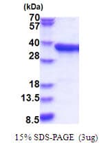 Human PPA2 Protein (Recombinant His)