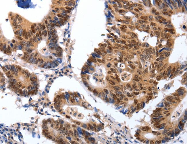 MAP2K1 / MKK1 / MEK1 Antibody