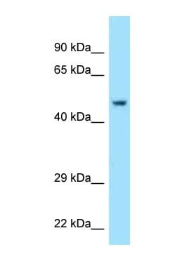 Polyclonal Rabbit anti-Human Acrosin Antibody (aa231-280, WB)