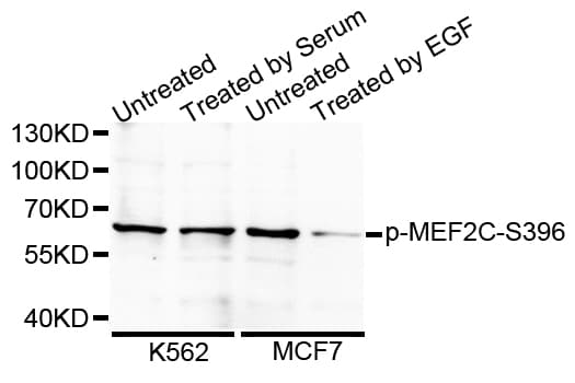 Polyclonal Rabbit anti-Human MEF2C Antibody (phospho-Ser396, IF, WB)