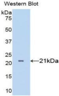 TNF Alpha Antibody (aa77-232, Cy3)