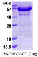 Human NAP1L1 Protein (Recombinant His)