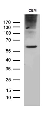 Monoclonal Mouse anti-Human TSPAN7 / CD231 Antibody (clone OTI2D6, IHC, WB)