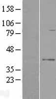RPUSD3 Protein (Over-Expression Lysate Myc-DDK (Flag))
