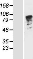 PATL1 Protein (Over-Expression Lysate Myc-DDK (Flag))