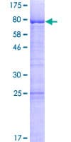 Human LSM14A Protein (Recombinant GST)