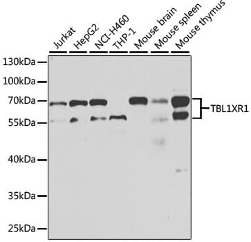 TBL1XR1 / TBLR1 Antibody