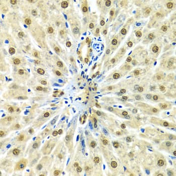 HNRNPA2B1 Antibody