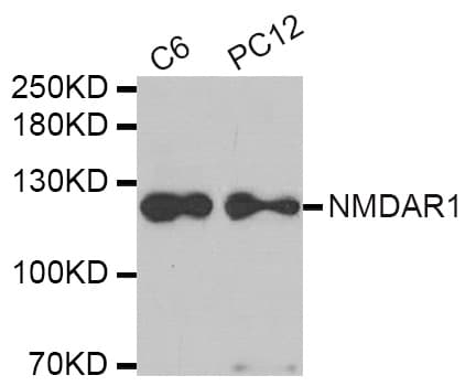 IHC-plus™ GRIN1 / NMDAR1 Antibody