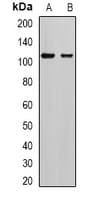 Polyclonal Rabbit anti-Human AP2A2 Antibody (IHC, WB)