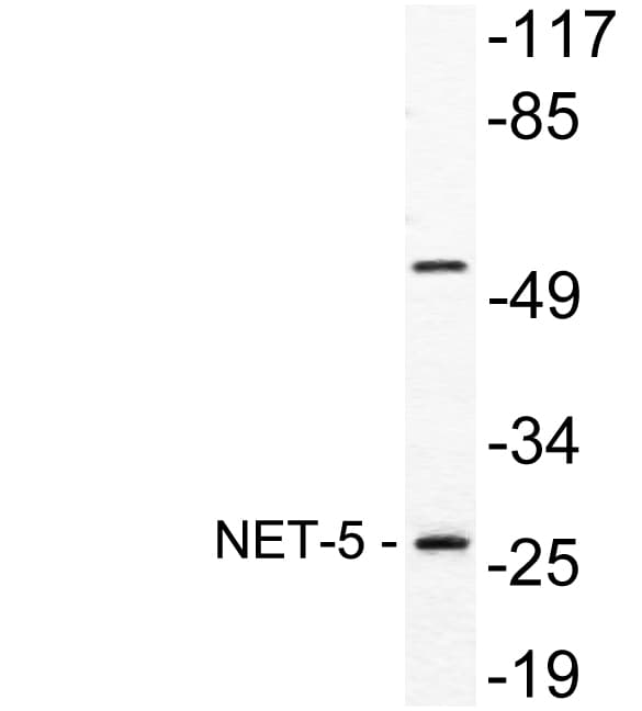 IHC-plus™ Polyclonal Rabbit anti-Human TSPAN9 Antibody (aa72-121, IHC, WB)