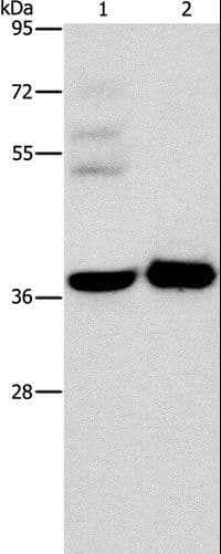 SERPINE2 / Nexin Antibody