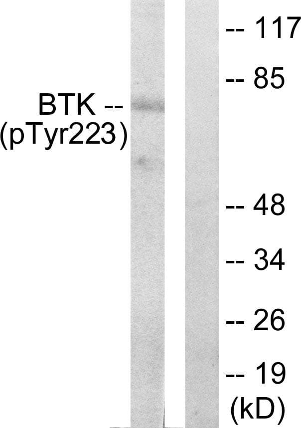 BTK Antibody (phospho-Tyr223)