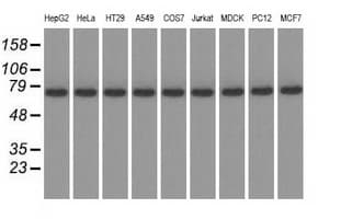 KBTBD7 Antibody (clone OTI1G3)