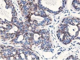 NUDT18 Antibody (clone OTI1A5)