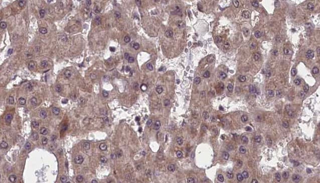 SLC4A4 / NBC1 Antibody