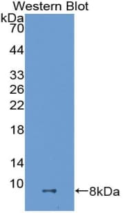 ADAMTS8 Antibody (aa832-889, PE)