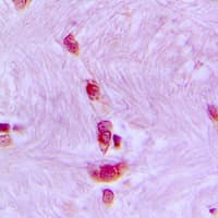 Polyclonal Rabbit anti-Human CDC40 Antibody (Internal, IHC, WB)