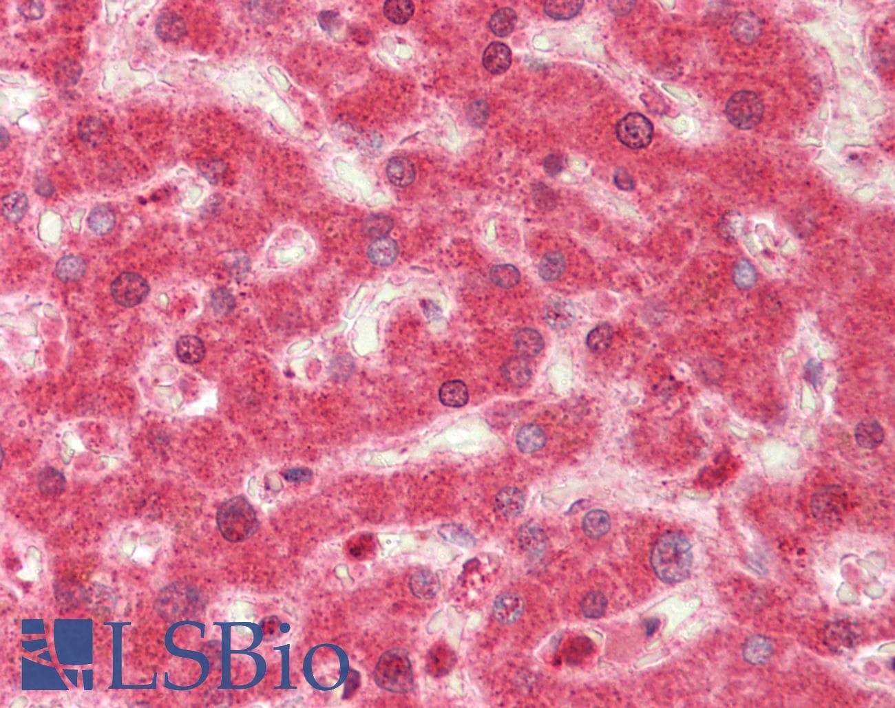 PathPlus™ Polyclonal Rabbit anti-Human NOS2 / iNOS Antibody (clone K13-A, IHC)