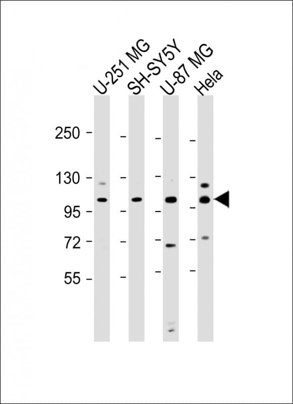 SH3PXD2B Antibody (Internal)