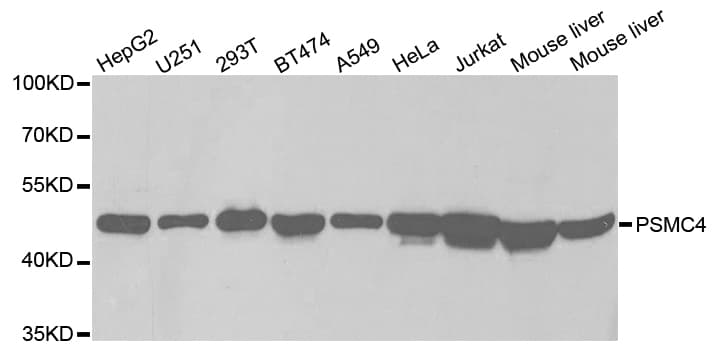 Polyclonal Rabbit anti-Human PSMC4 Antibody (IHC, IF, WB)