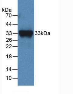 Polyclonal Rabbit anti-Mouse F11 / FXI / Factor XI Antibody (aa157-389, WB)