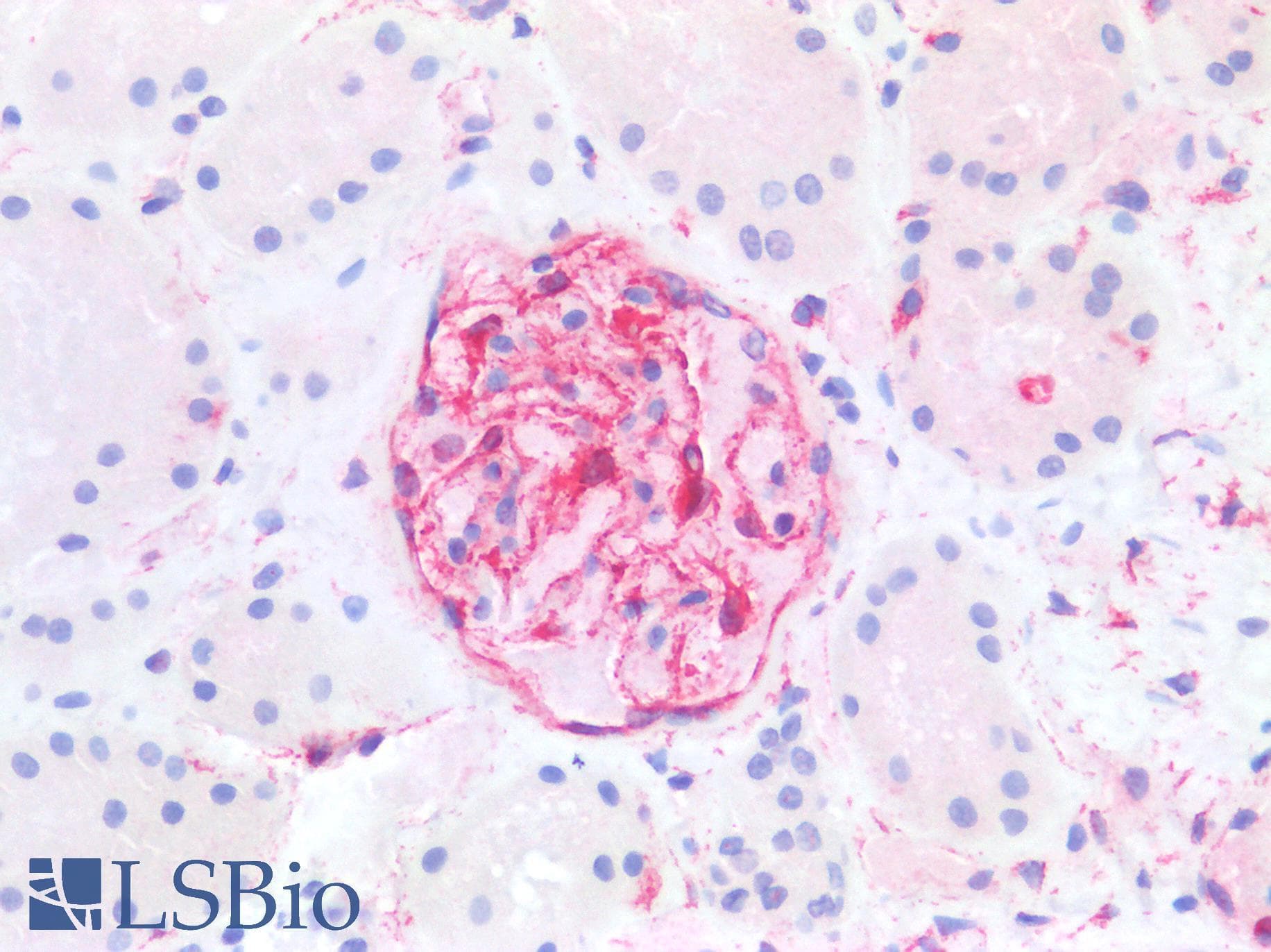 PathPlus™ Vimentin Antibody