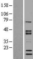 SNW1 / SKIP Protein (Over-Expression Lysate Myc-DDK (Flag))