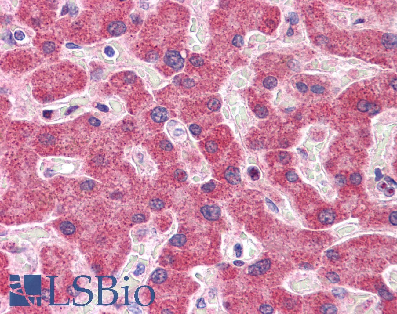 IHC-plus™ Polyclonal Rabbit anti-Human NDUFAF2 / NDUFA12L Antibody (IHC, IF, WB)