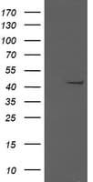 MAP2K1 / MKK1 / MEK1 Antibody (clone OTI7E2)