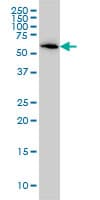 B4GALNT1 / GM2/GD2 Synthase Antibody (clone 5F9)