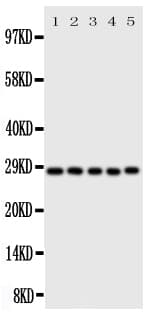 CASP14 / Caspase 14 Antibody (aa223-242)