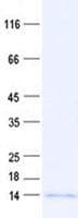 Human HMSD Protein (Recombinant His, N-Terminal)