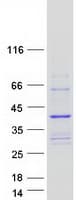 Human COLEC11 Protein (Recombinant Myc-DDK (Flag))