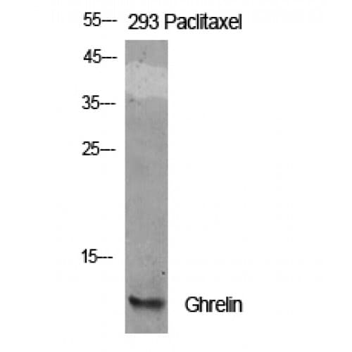 Polyclonal Rabbit anti-Human Ghrelin Antibody (Internal, IHC, WB)