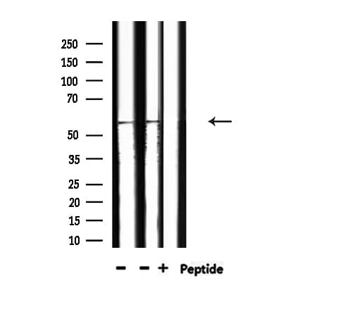 SRC Antibody (phospho-Tyr530)