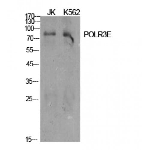 Polyclonal Rabbit anti-Human POLR3E / SIN Antibody (160-240 aa, Internal, IHC, IF, WB)