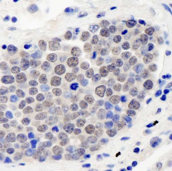 COPS3 / CSN3 Antibody (aa325-375)