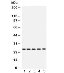SOD2 / Mn SOD Antibody
