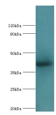 IHC-plus™ ALKBH1 / ALKB Antibody (aa110-389)