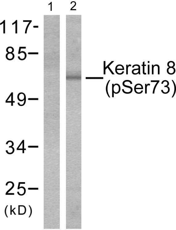 KRT8 / CK8 / Cytokeratin 8 Antibody (phospho-Ser73)