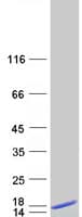 Human ACYP2 Protein (Recombinant Myc-DDK (Flag))